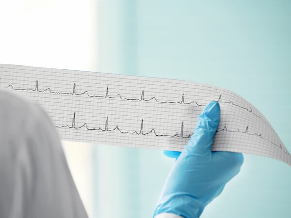 Kardiološki Pregled I Elektrokardiogram (EKG) - IMedic Ordinacija