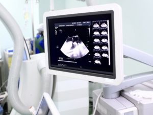 Kardiološki Pregled- Ultrazvuk Srca Sa Kolor Doplerom - IMedic Ordinacija