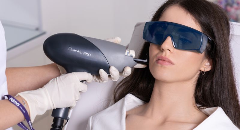 clearskin laser beograd