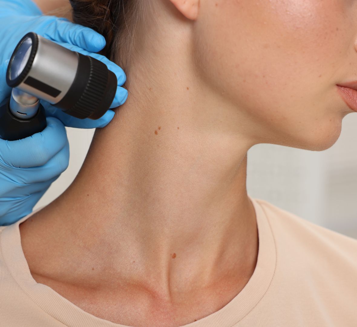 biopsija kože beograd