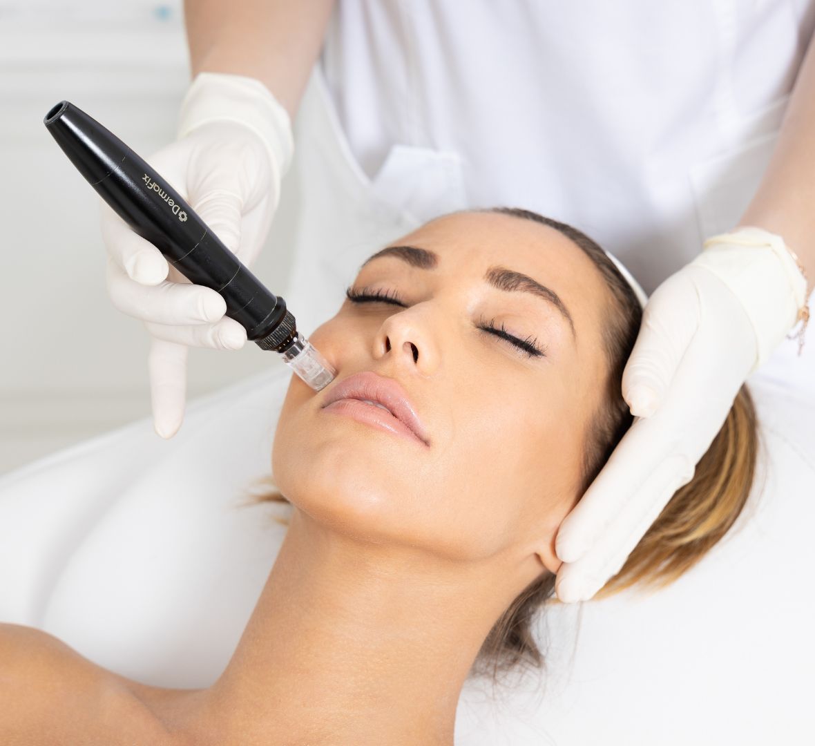 dermapen cena beograd