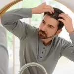 muški tip ćelavosti