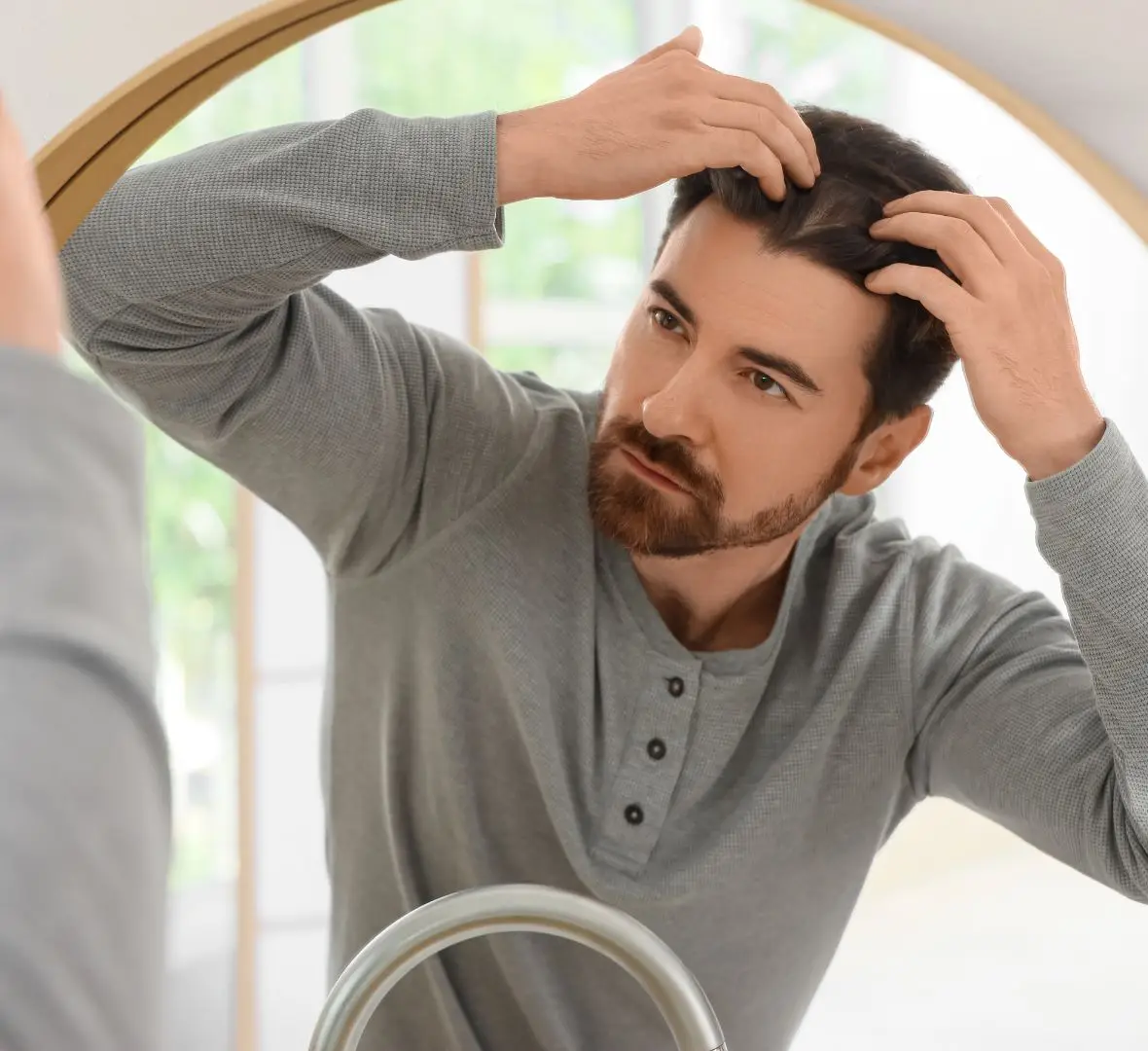 muški tip ćelavosti