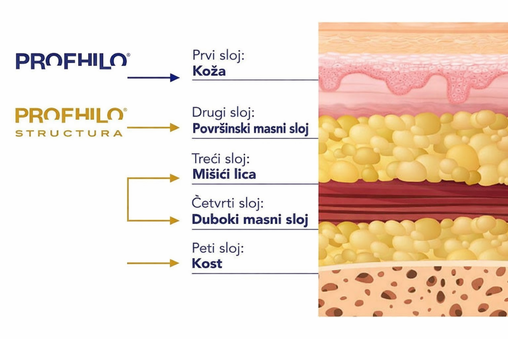 profhilo structura  tretman.