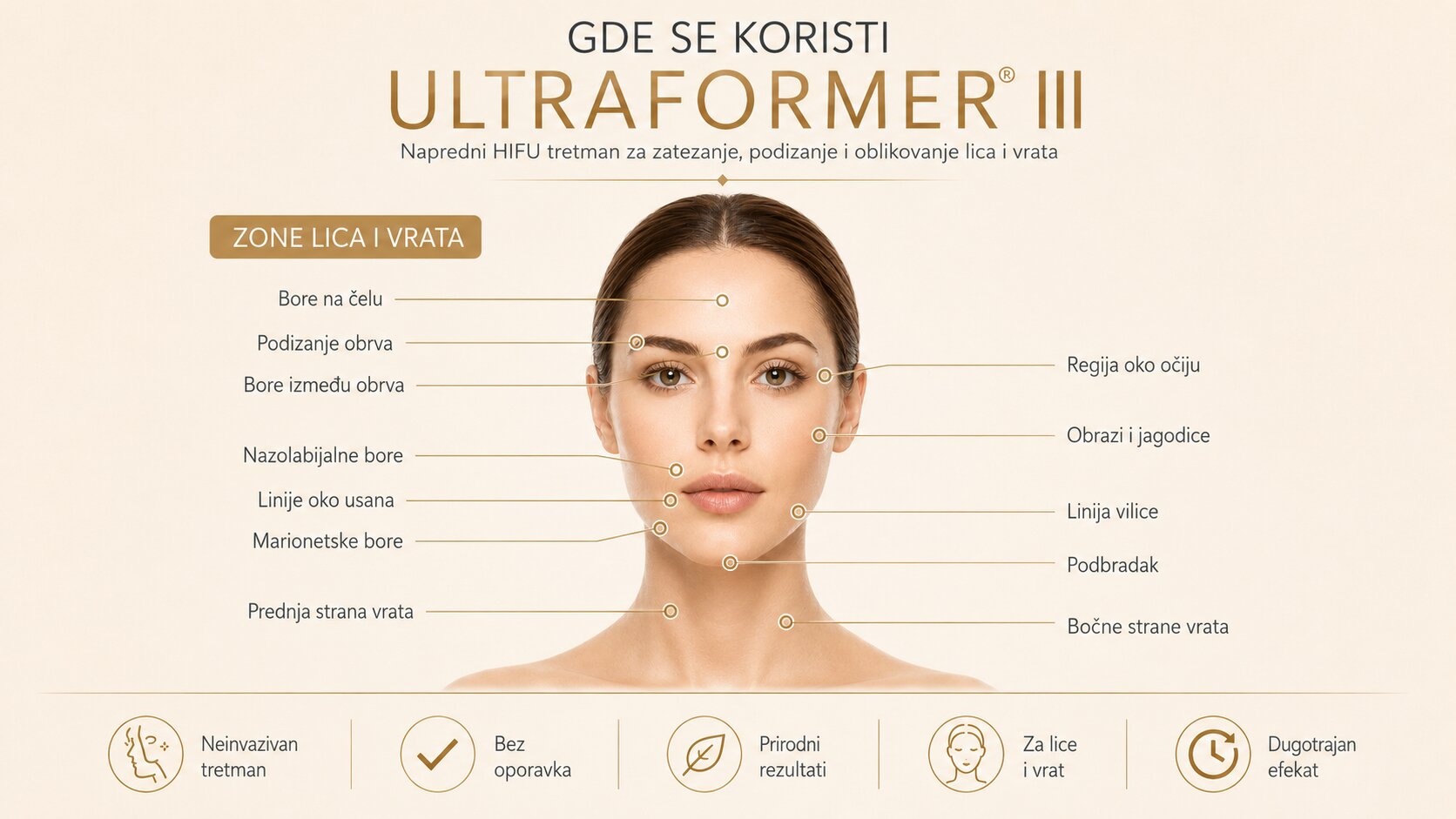 ultraformer III zatezanje lica i vrata (2)