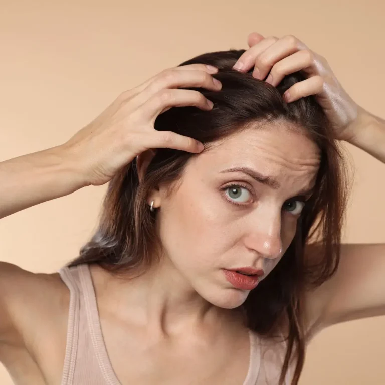 Androgenetska alopecija kod žena