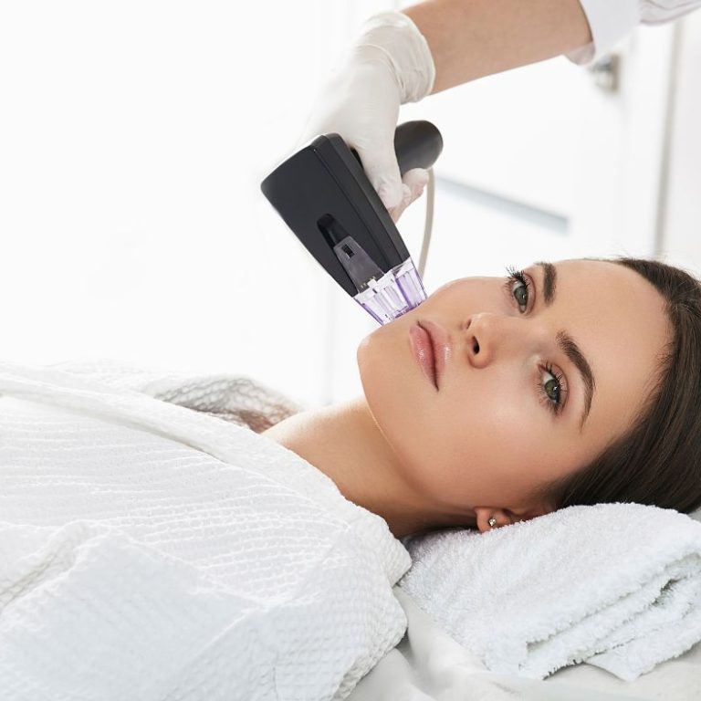 Radiotalasni lifting